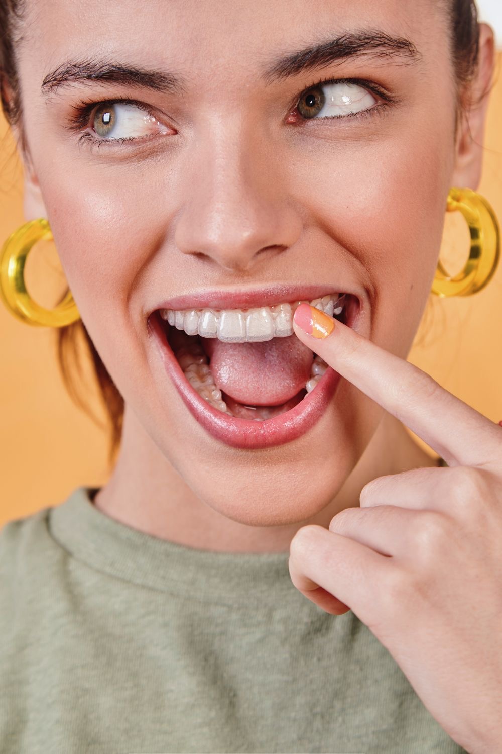Placing a clear Invisalign aligner