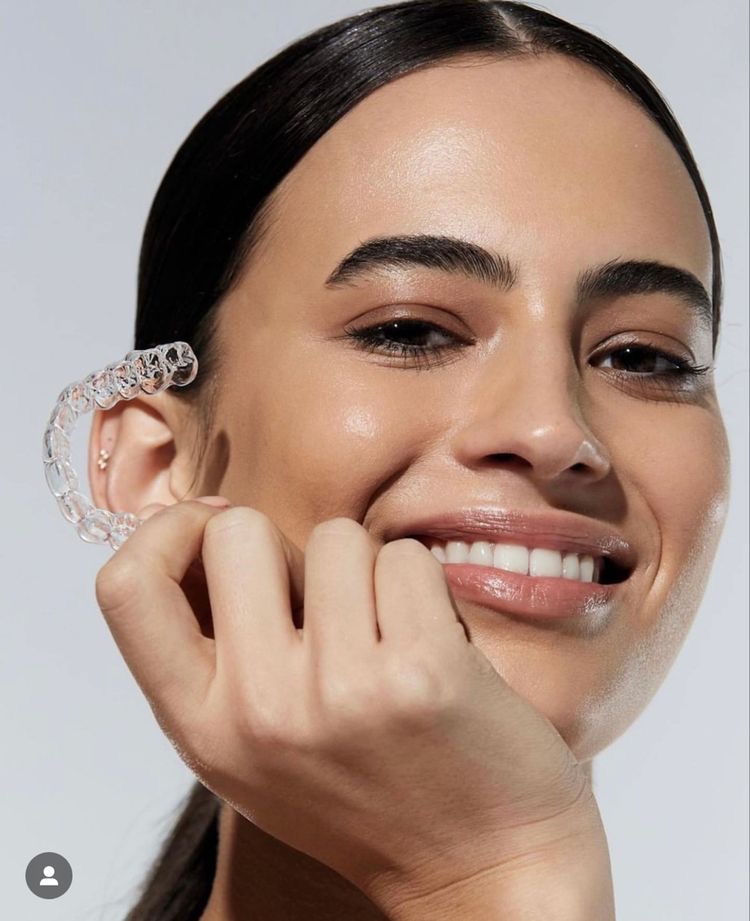 Custom clear aligner design